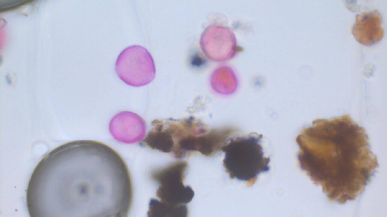 Lichtmicroscoop foto waarop zowel pollen als fijnstof te zien is.
