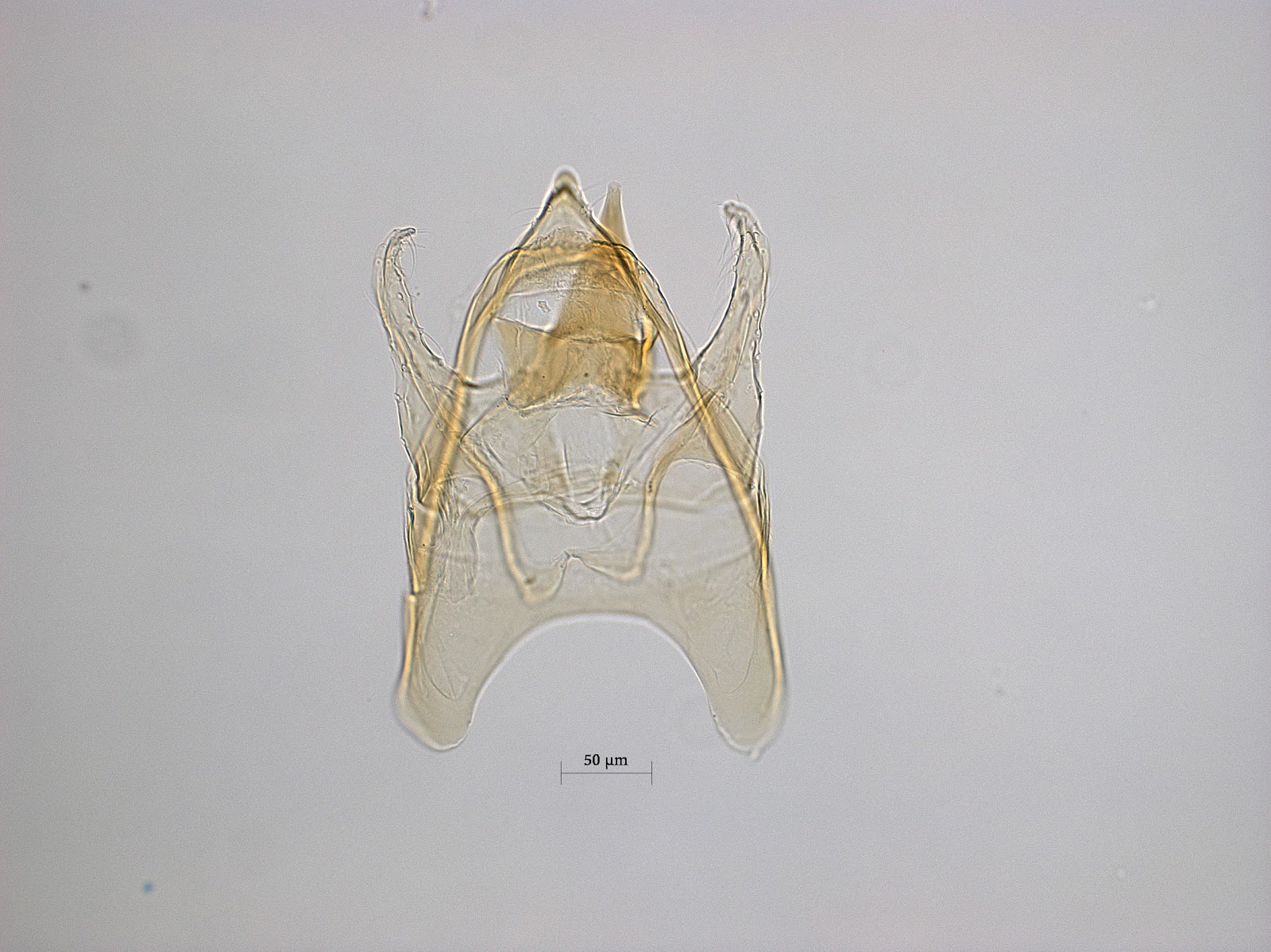 Manlijk genitaal van een onbeschreven Nepticulide 