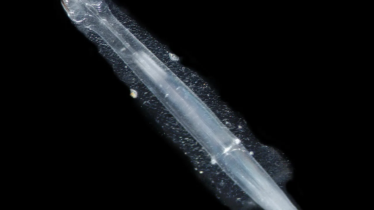 chaetognath eats an chaetognath