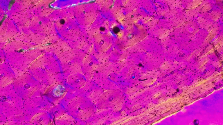 Compact bone under a microscope. This image is from a rib in a fossil deer.