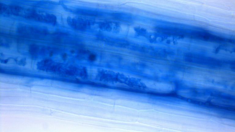 Microscopische foto van boom-achtige structuren van een arbusculaire mycorrhiza schimmel in het binnenste van een plant wortel.