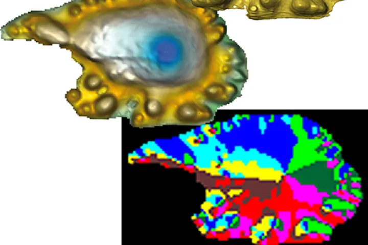 Acanthodian