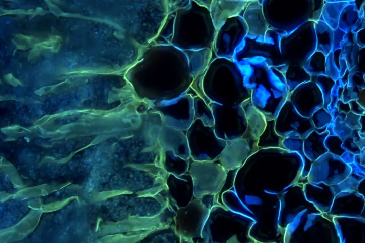 Cyanobacteria (blue dots) inside the coralloid cycad root