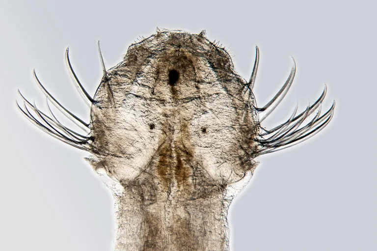 The head of an arrow worm